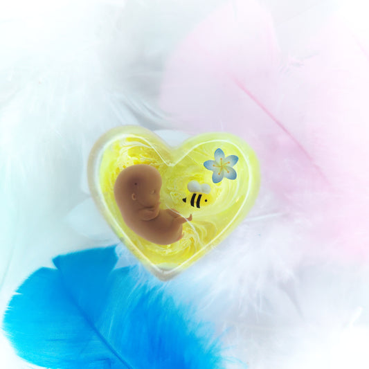 8-11 Week Baby Loss Hear